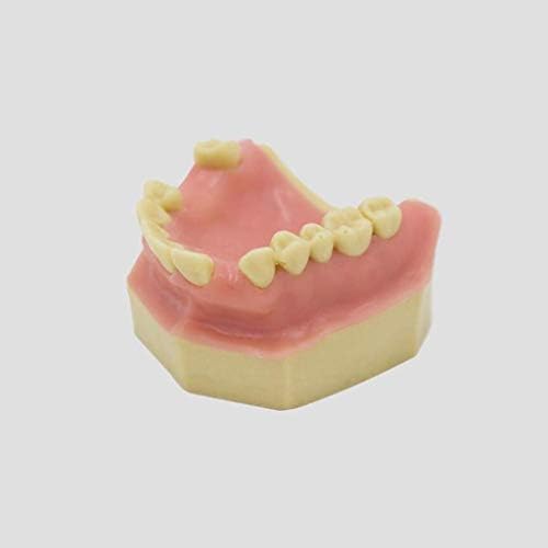 LEMITA Oral İmplant Uygulama Modeli-Diş Diş Modeli Yumuşak Diş Etleri Gösteri Diş Modeli için Hasta Eğitim Eğitim Yardımları Protez